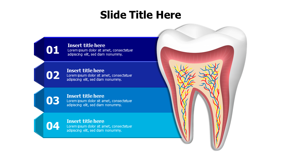 4 points 3D tooth infographic